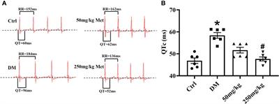 Metformin Shortens Prolonged QT Interval in Diabetic Mice by Inhibiting L-Type Calcium Current: A Possible Therapeutic Approach